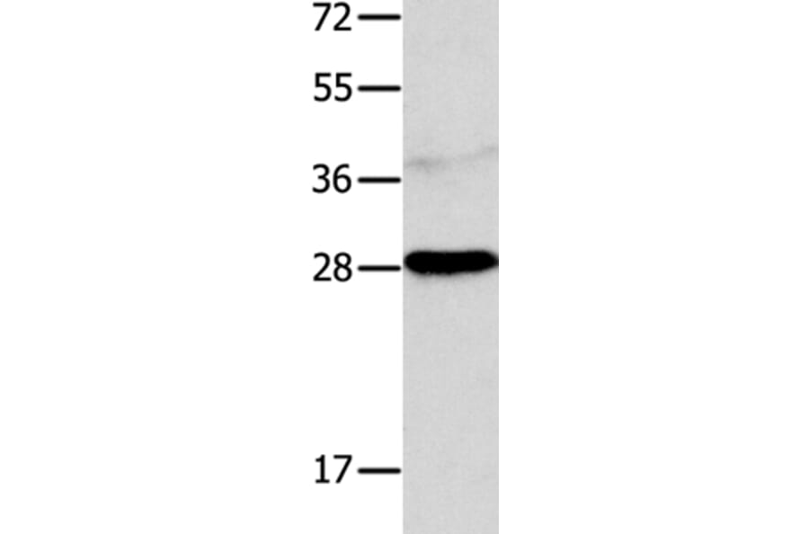 NTF4 Antibody from Signalway Antibody (35846) - Antibodies.com