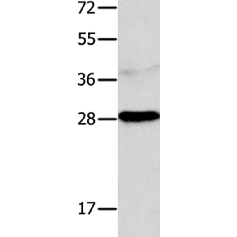 NTF4 Antibody from Signalway Antibody (35846) - Antibodies.com