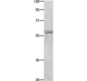OASL Antibody from Signalway Antibody (35849) - Antibodies.com