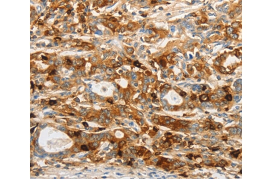 Immunohistochemistry - OASL Antibody from Signalway Antibody (35849) - Antibodies.com