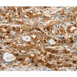 Immunohistochemistry - OASL Antibody from Signalway Antibody (35849) - Antibodies.com