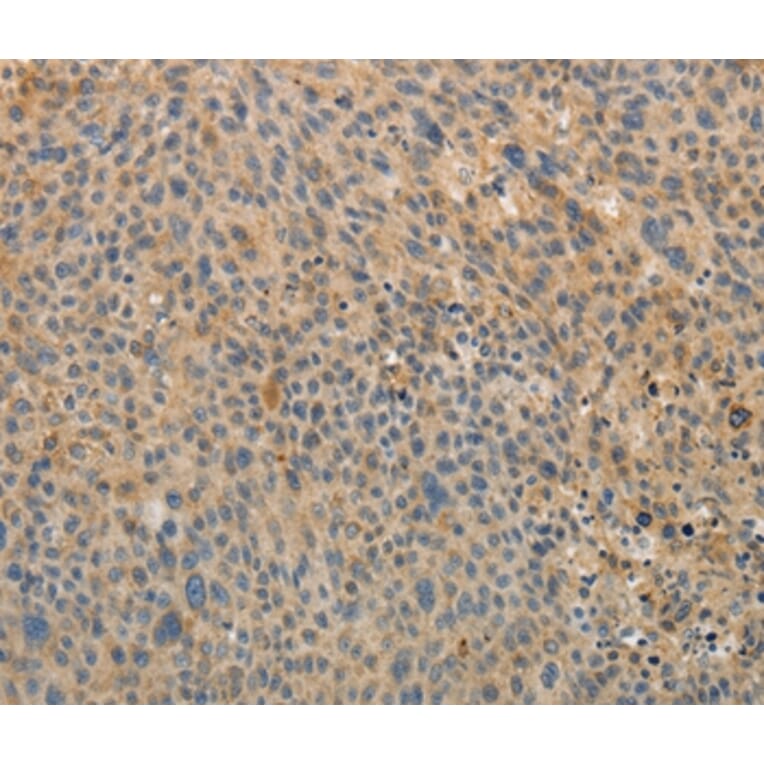 Immunohistochemistry - OCLN Antibody from Signalway Antibody (35850) - Antibodies.com