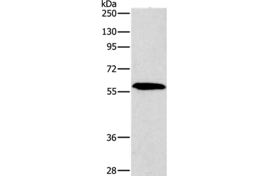 PAK2 Antibody from Signalway Antibody (35863) - Antibodies.com