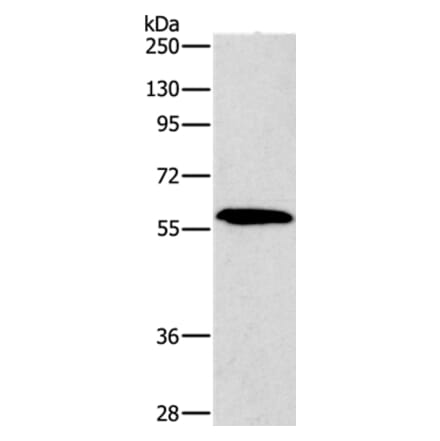 PAK2 Antibody from Signalway Antibody (35863) - Antibodies.com