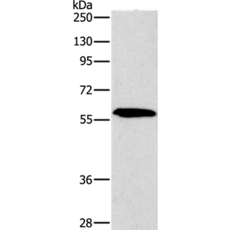 PAK2 Antibody from Signalway Antibody (35863) - Antibodies.com