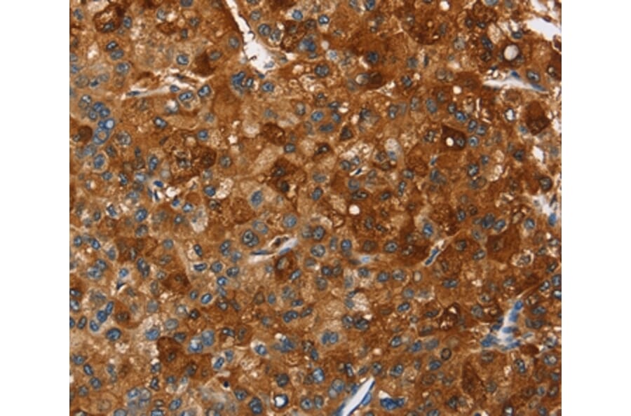 Immunohistochemistry - PAK2 Antibody from Signalway Antibody (35863) - Antibodies.com
