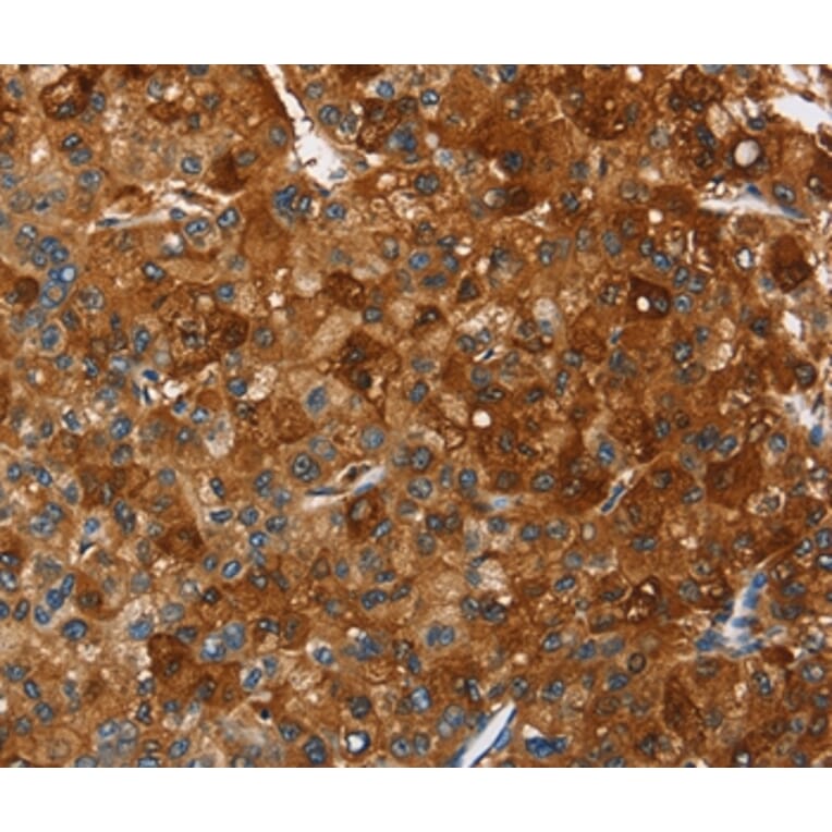 Immunohistochemistry - PAK2 Antibody from Signalway Antibody (35863) - Antibodies.com