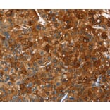 Immunohistochemistry - PAK2 Antibody from Signalway Antibody (35863) - Antibodies.com