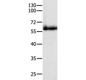 PAK4 Antibody from Signalway Antibody (35864) - Antibodies.com