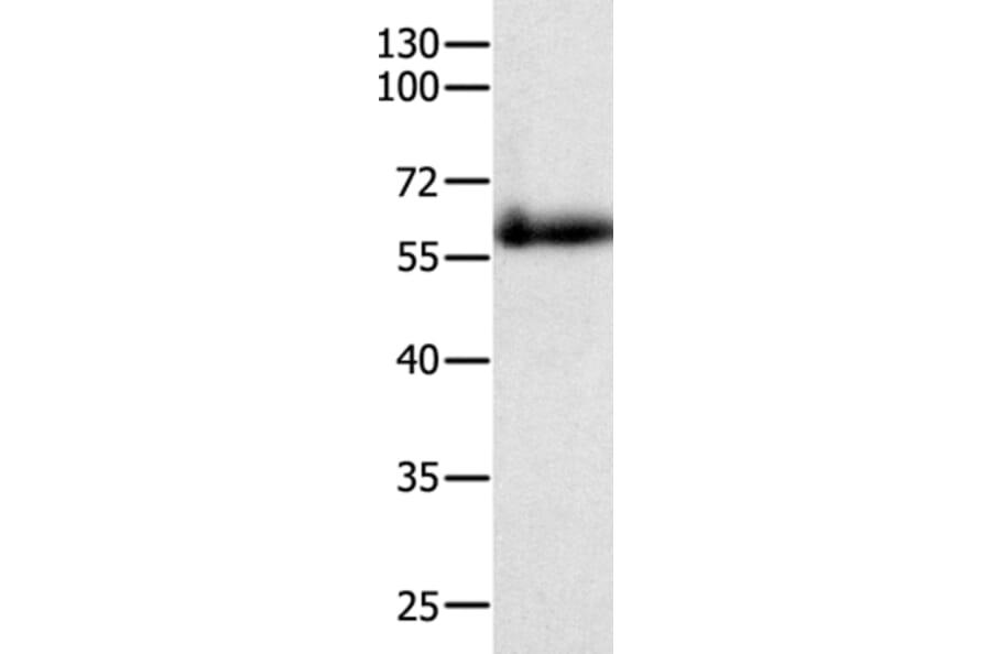 PAK4 Antibody from Signalway Antibody (35864) - Antibodies.com