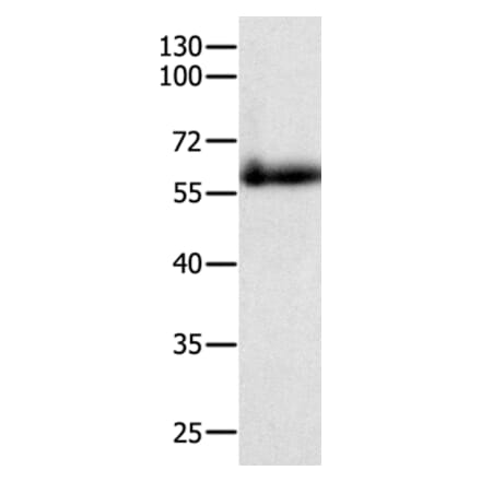 PAK4 Antibody from Signalway Antibody (35864) - Antibodies.com