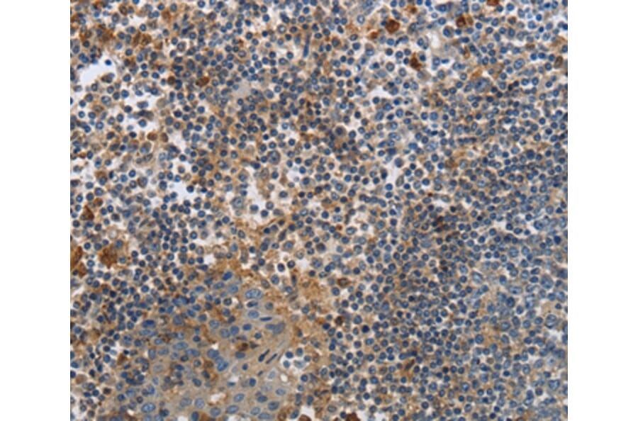 Immunohistochemistry - PAK4 Antibody from Signalway Antibody (35864) - Antibodies.com