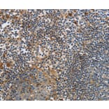 Immunohistochemistry - PAK4 Antibody from Signalway Antibody (35864) - Antibodies.com