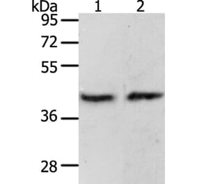 PAX8 Antibody from Signalway Antibody (35870) - Antibodies.com