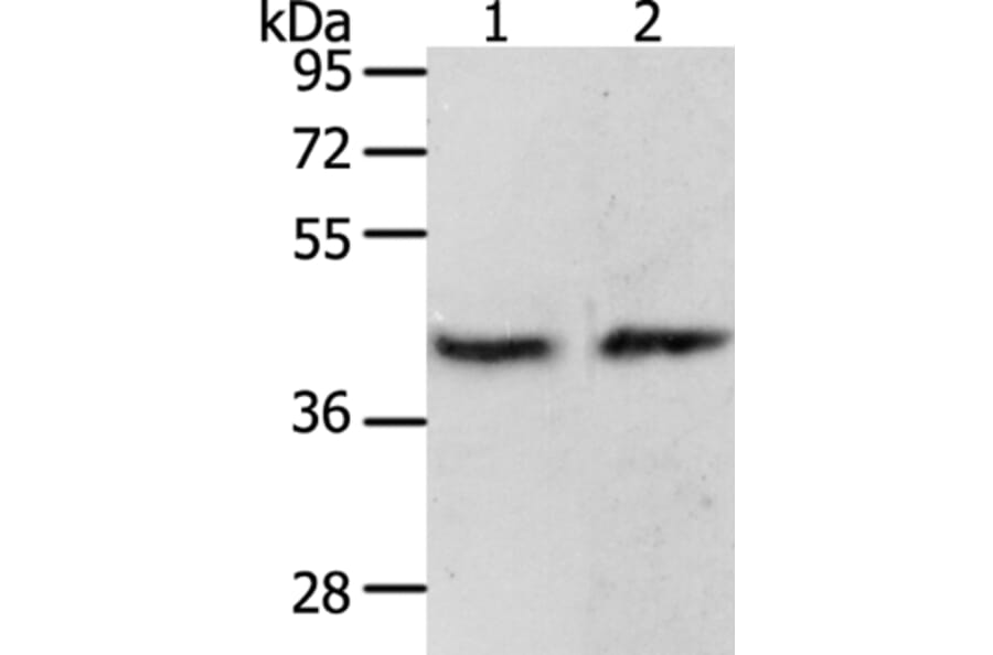 PAX8 Antibody from Signalway Antibody (35870) - Antibodies.com