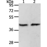 PAX8 Antibody from Signalway Antibody (35870) - Antibodies.com