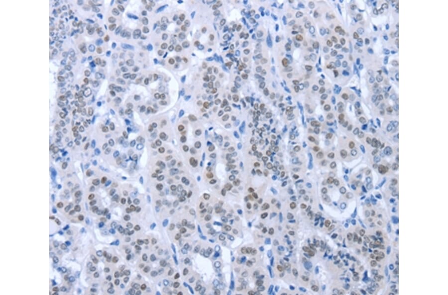 Immunohistochemistry - PAX8 Antibody from Signalway Antibody (35870) - Antibodies.com