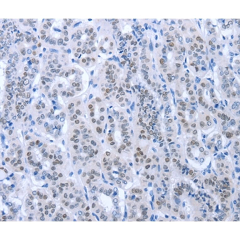 Immunohistochemistry - PAX8 Antibody from Signalway Antibody (35870) - Antibodies.com