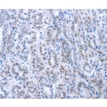 Immunohistochemistry - PAX8 Antibody from Signalway Antibody (35870) - Antibodies.com