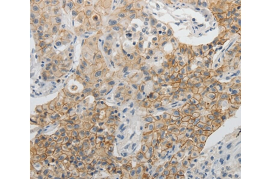 Immunohistochemistry - CDH3 Antibody from Signalway Antibody (35871) - Antibodies.com