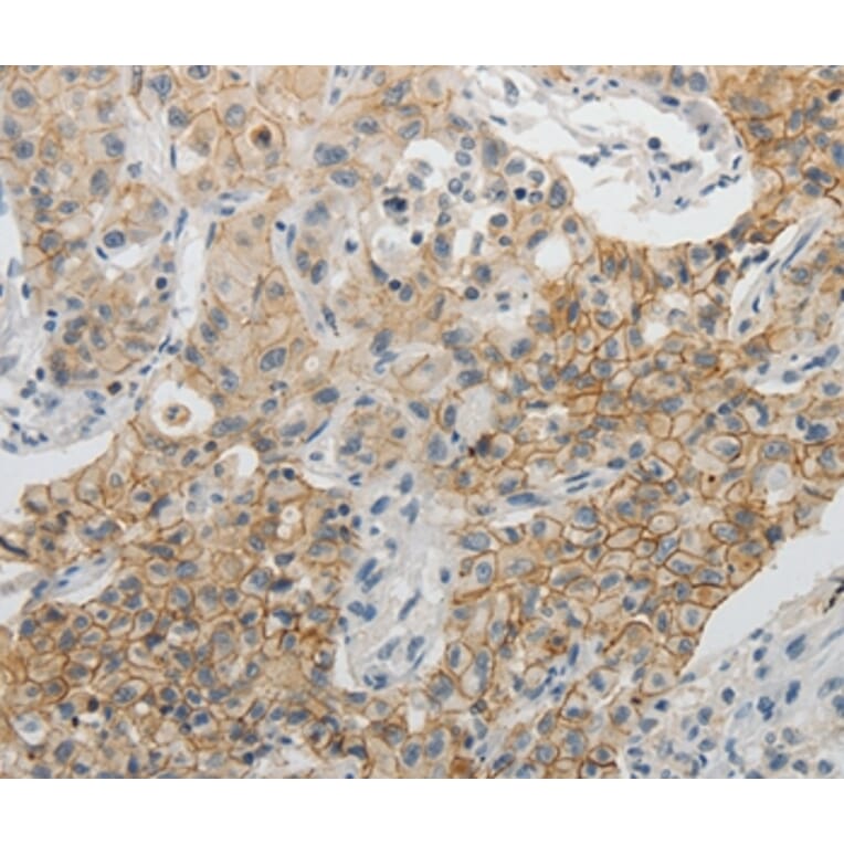 Immunohistochemistry - CDH3 Antibody from Signalway Antibody (35871) - Antibodies.com