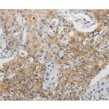 Immunohistochemistry - CDH3 Antibody from Signalway Antibody (35871) - Antibodies.com
