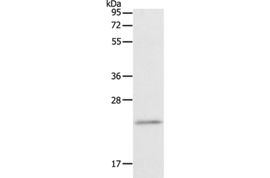 RGS2 Antibody from Signalway Antibody (35906) - Antibodies.com