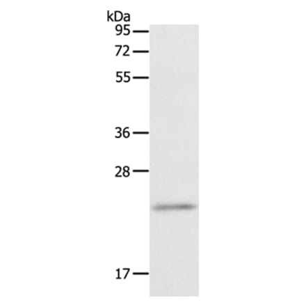 RGS2 Antibody from Signalway Antibody (35906) - Antibodies.com