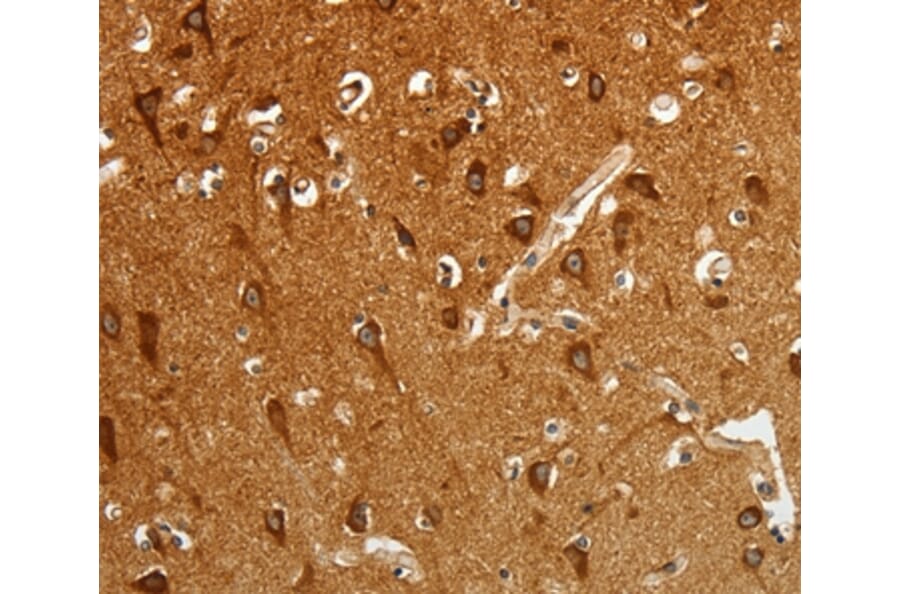 Immunohistochemistry - RGS2 Antibody from Signalway Antibody (35906) - Antibodies.com