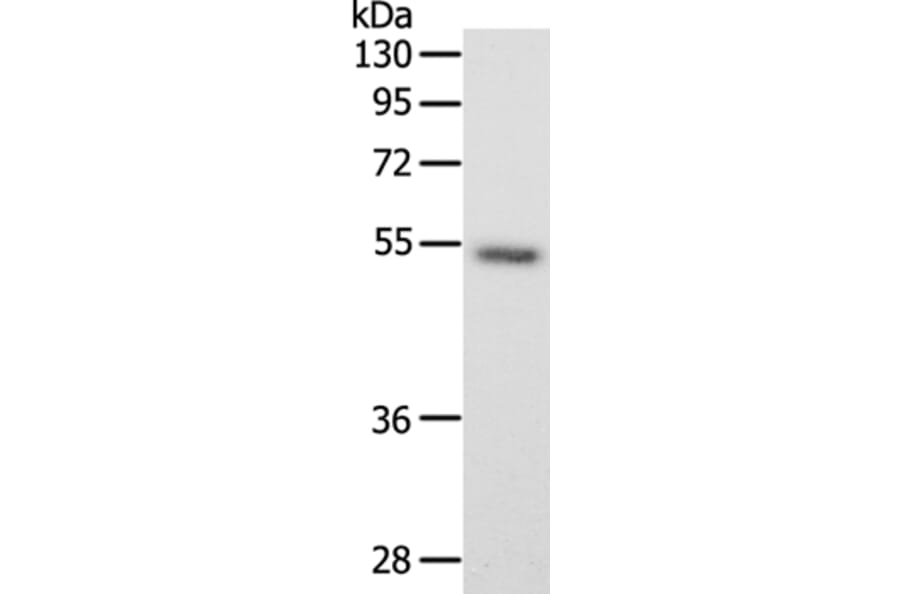 SCG3 Antibody from Signalway Antibody (35910) - Antibodies.com