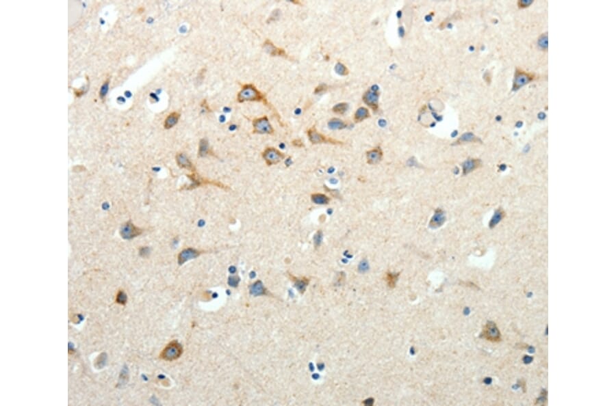 Immunohistochemistry - SCG3 Antibody from Signalway Antibody (35910) - Antibodies.com
