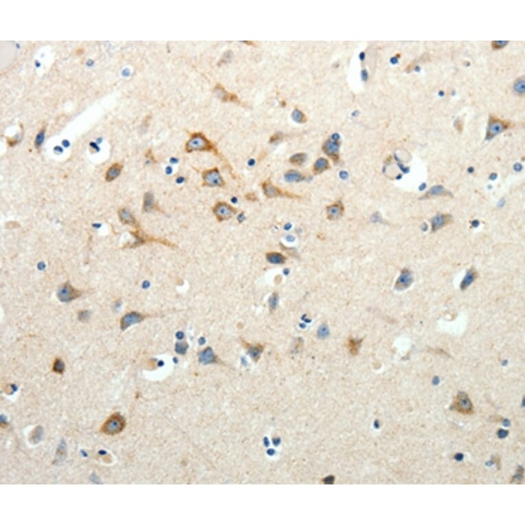 Immunohistochemistry - SCG3 Antibody from Signalway Antibody (35910) - Antibodies.com