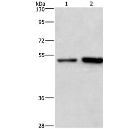 SYT4 Antibody from Signalway Antibody (35935) - Antibodies.com