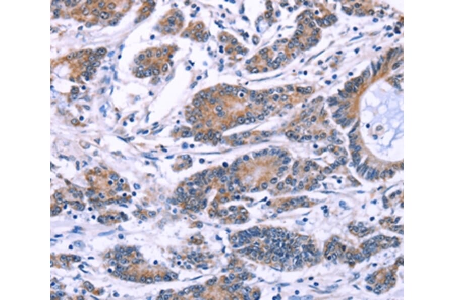 Immunohistochemistry - SYT4 Antibody from Signalway Antibody (35935) - Antibodies.com