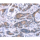 Immunohistochemistry - SYT4 Antibody from Signalway Antibody (35935) - Antibodies.com