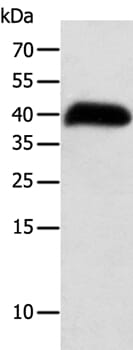 Gel: 10% SDS-PAGE Lysates (from left to right): Human thigh malignant fibrous histiocytoma tissue Amount of lysate: 40ug per lane Primary antibody: 1/100 dilution Secondary antibody dilution: 1/8000 Exposure time: 8 hours