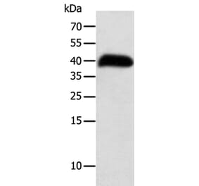 SYT5 Antibody from Signalway Antibody (35936) - Antibodies.com