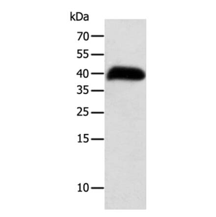 SYT5 Antibody from Signalway Antibody (35936) - Antibodies.com