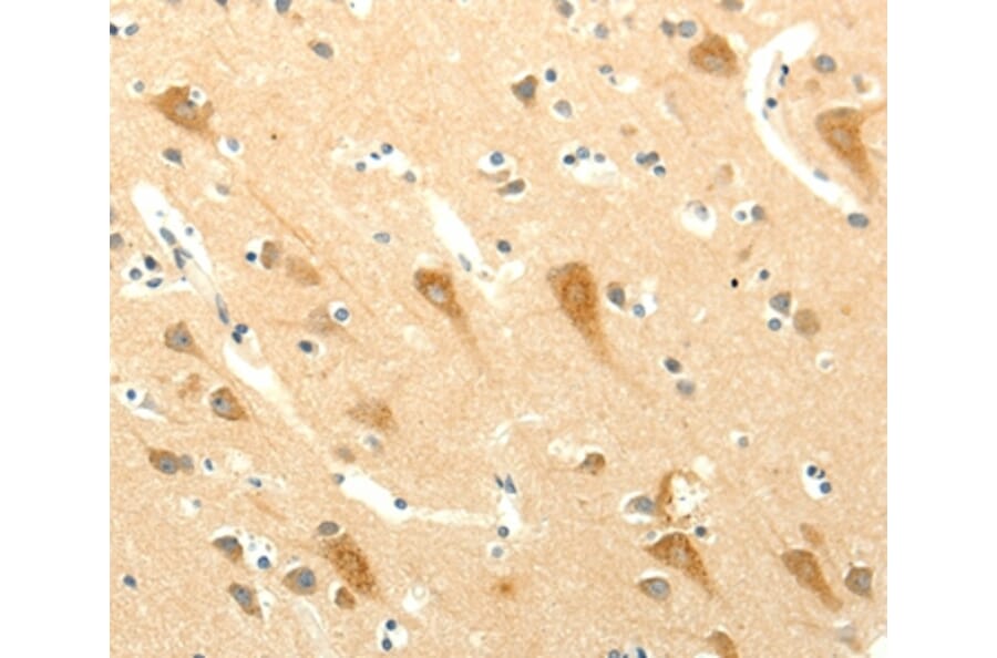 Immunohistochemistry - SYT5 Antibody from Signalway Antibody (35936) - Antibodies.com