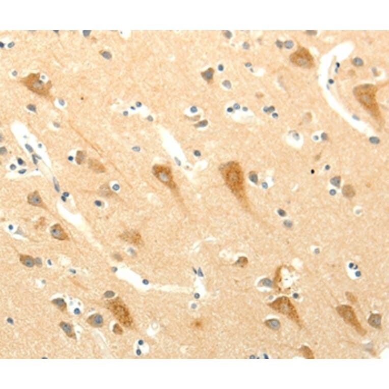 Immunohistochemistry - SYT5 Antibody from Signalway Antibody (35936) - Antibodies.com