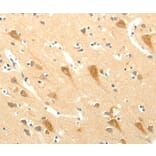 Immunohistochemistry - SYT5 Antibody from Signalway Antibody (35936) - Antibodies.com