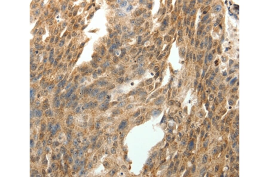 Immunohistochemistry - SYT7 Antibody from Signalway Antibody (35938) - Antibodies.com