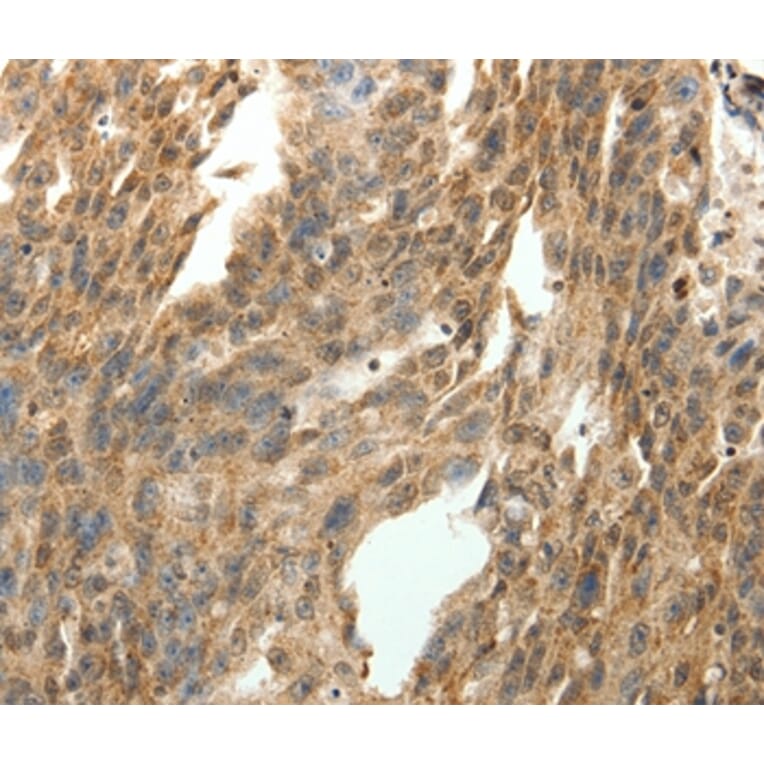 Immunohistochemistry - SYT7 Antibody from Signalway Antibody (35938) - Antibodies.com