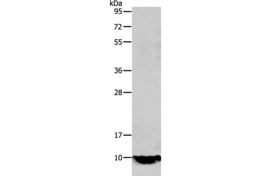 TFF1 Antibody from Signalway Antibody (35953) - Antibodies.com