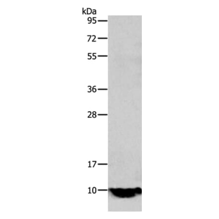 TFF1 Antibody from Signalway Antibody (35953) - Antibodies.com