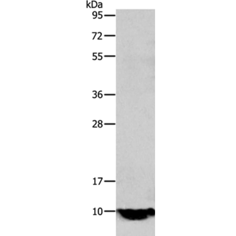 TFF1 Antibody from Signalway Antibody (35953) - Antibodies.com
