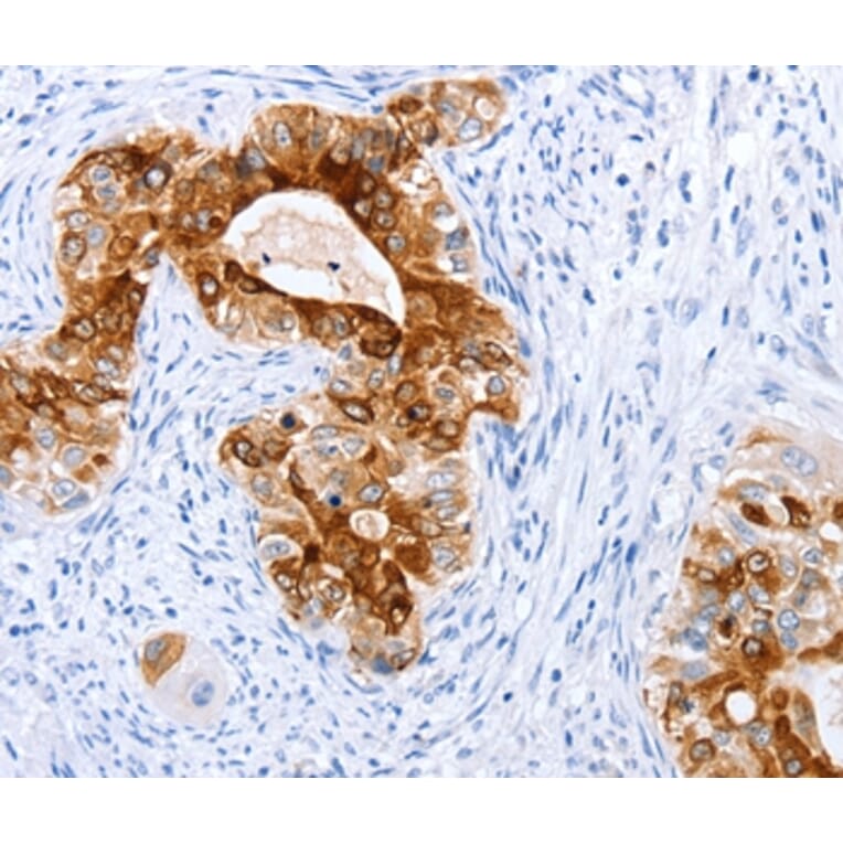 Immunohistochemistry - TFF1 Antibody from Signalway Antibody (35953) - Antibodies.com