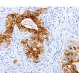 Immunohistochemistry - TFF1 Antibody from Signalway Antibody (35953) - Antibodies.com