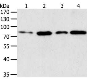 TGM2 Antibody from Signalway Antibody (35959) - Antibodies.com