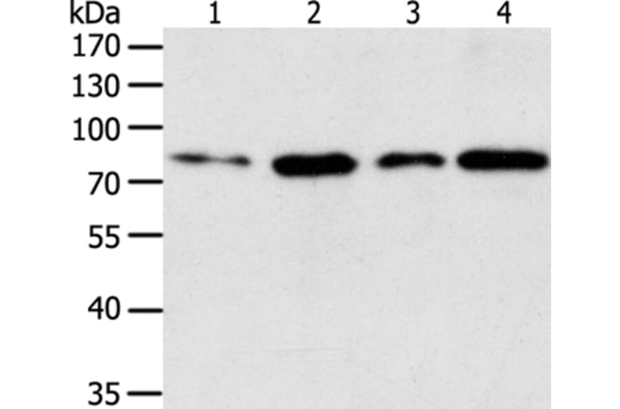 TGM2 Antibody from Signalway Antibody (35959) - Antibodies.com